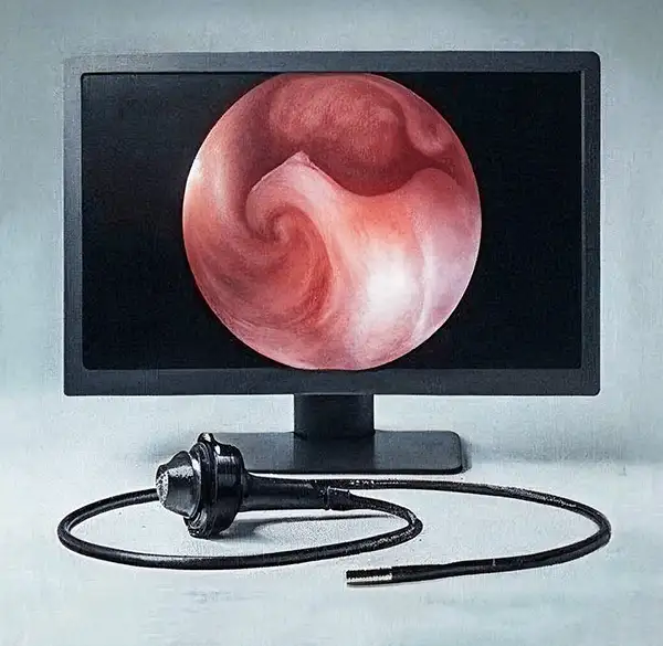 Flexible Cystoscopy